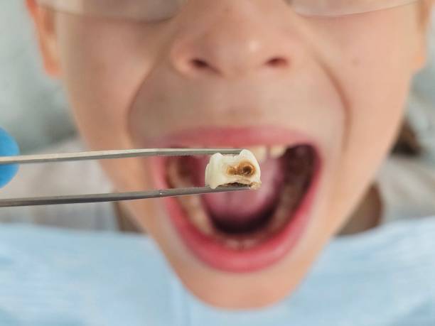 Best Weekend Emergency Dentist in Haskins, OH